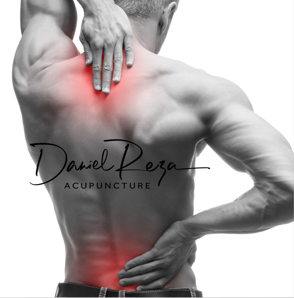 Dos - Daniel Reza Acupuncture